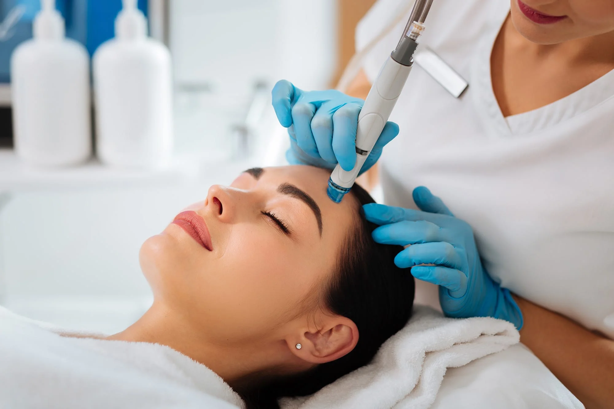 A HydraFacial wand applied to the forehead.