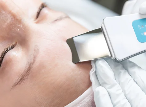An ultrasonic exfoliation tool applied to the cheek.