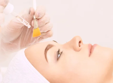 A facial peel applied with a brush.