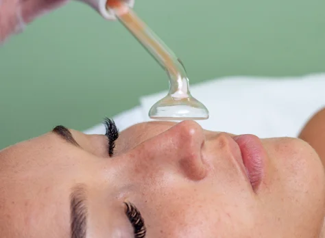 A high-frequency facial wand used during an acne-focused treatment.