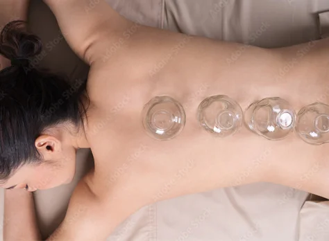 Cupping massage with cups placed along the back.